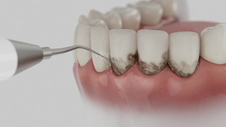 Reliable Dental Implants contractor in Carrington, ND by Smile Center Dentistry